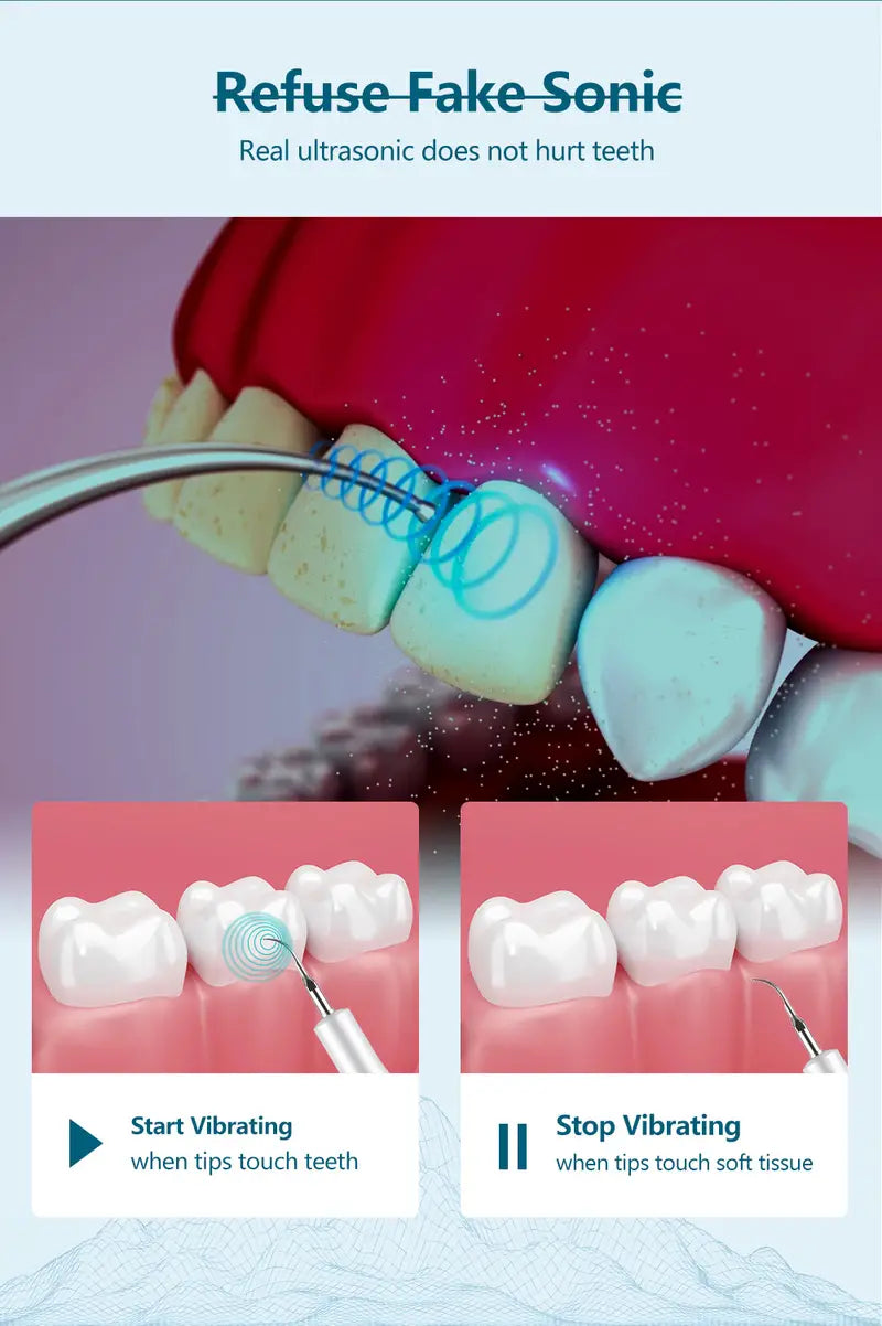 Ultrasonic Dental Scaler for Teeth Whitening & Cleanup